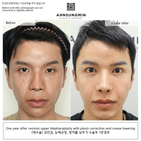 Why Repeated Fold Lowering Created a Double Crease.