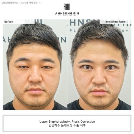 Men also want their eyes to look bigger!